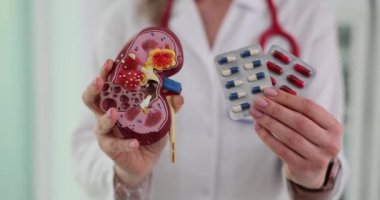 Kadın doktor, tedavi edilmemiş böbrek hasarının sonuçlarını gösteriyor. Doktor ilaç tedavisinin faydalarını göstermek için böbrek modeli kullanıyor.