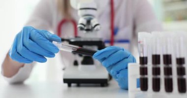 Laboratuvar asistanı test tüpünü hasta kan örneğiyle birlikte masada mikroskobun önünde tutuyor. Kadın doktor hastanede tıbbi testler yapıyor.