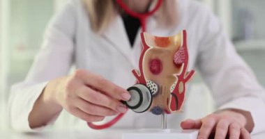 Doktor, iltihaplı vasküler yapıları olan sağlıksız alt rektum modelini tutuyor. Basur ve tedavi sorunu