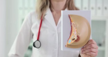 Mammolog kadın göğsünün anatomik modelini gösteriyor. Göğüs kanseri ve meme iltihabı önleme ve tedavi kavramı
