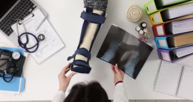 Travmatolog, bacağı kırık ve röntgeni klinikte olan bir hastayı muayene ediyor. Kırık ve bacak yaralanması.