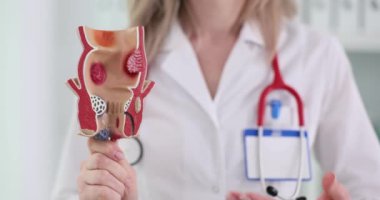 Doktor rektumun anatomik modelini tutuyor. Rektumun koloproktoloji ve neoplastik olmayan hastalıkları