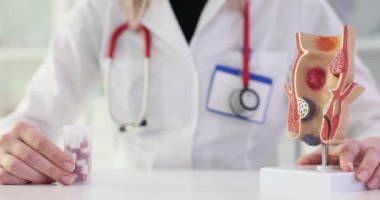 Doktor proktolog rektumun anatomik modelini ve haplarını tutuyor. Proktolojik hastalıkların tedavisi