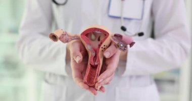 Kadın üreme sisteminin anatomi modeli doktorların elinde. Servikal patolojinin teşhisi ve tedavisi