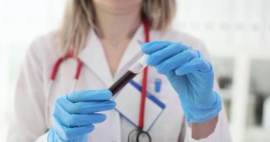 Doktor kan örneğini laboratuvarda tutuyor. Kan örneği alma kuralları, araştırma yöntemleri ve kuralları