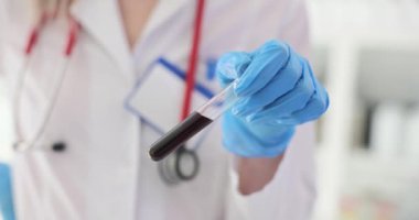 Doktor test tüpünde kan örneği tutuyor. Klinik teşhis laboratuvarı ve kan testi