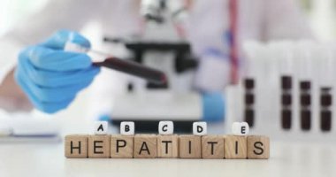 Tahta bloklar laboratuvarda hepatit A, B, C, D ve E tespit etti. Viral hepatit ve birincil teşhis