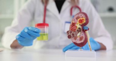 Klinikteki böbrek sağlığı ve idrar tahlili gösterileri. İdrar yolu anatomisi ve idrar değişimi.