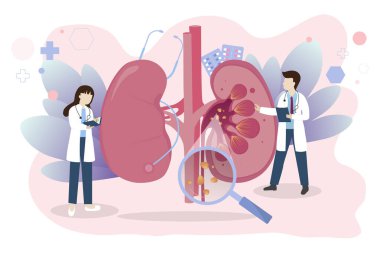 İnsan böbrek taşı tıbbi konsepti. Nefroloji vektör illüstrasyonu. Doktor, beyaz arka planda urolithiasis hastalığını inceler ve teşhis eder..
