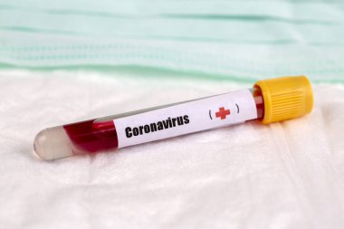 Çin 'den yeni Corona Virüsü salgını için aşı konsepti, Wuhan. Tıbbi Şırınga Depolama ve Tıbbi Şırınga 'da Salgın Koronavirüsü için Bağışıklık Aşılama.