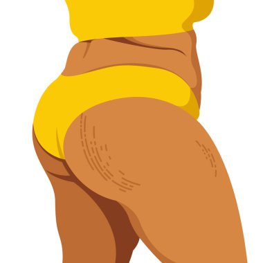 vector image on the theme of body positivity. a curvy girl is not shy of fat folds on her body and stretch marks on her hips. isolated on white background. love and accept your body. love yourself.
