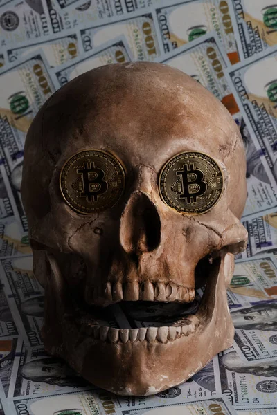 Uma Moeda Ouro Com Símbolo Criptomoeda Bitcoin Nas Órbitas Oculares — Fotografia de Stock