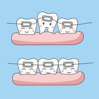 Sevimli diş teli karakteri. Diş bakımı ve tedavi konsepti. Gülümseyen bebek dişi sembolü. Düz vektör illüstrasyonu