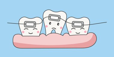 Sevimli gülümseyen dişler karakterleri teller. Diş bakımı ve tedavi çocuk konsepti çizimleri. Diş sağlığı kliniği maskotu. Çizgi film vektör illüstrasyonu
