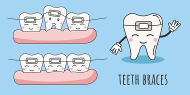Bir dizi diş teli çizgi film karakterlerini destekler. Diş bakımı ve tedavi çocuk konsepti çizimleri. Diş sağlığı kliniği maskotu. Düz vektör illüstrasyonu