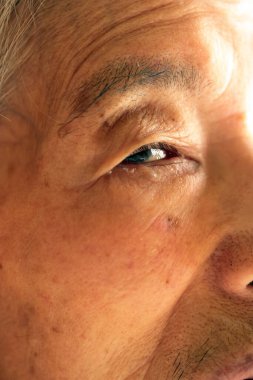 Depresif bir ifadeye sahip yaşlı bir kadının sağ gözüne yakın plan.