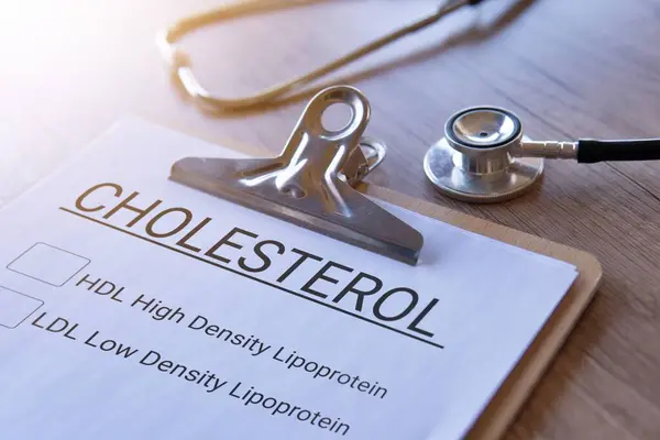 Stetoskop ve kağıt panonun yakın plan görüntüsü CHOLESTROL HDL ve LDL ile birlikte. Tıbbi ve sağlık hizmeti kavramı.