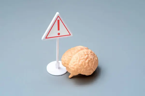 Uyarı işareti olan bir beyin modeli. Beyin sağlığı ve potansiyel risk kavramı.