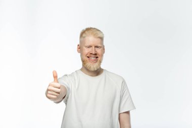 bearded albino man in t-shirt smiling and showing thumb up isolated on white  clipart