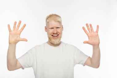 cheerful albino man in t-shirt waving hands isolated on white clipart