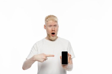 Şok olmuş albino tişörtlü adam beyaz ekranlı akıllı telefonu işaret ediyor 
