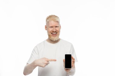 Beyaz ekranlı akıllı telefonu gösteren tişörtlü mutlu albino adam. 