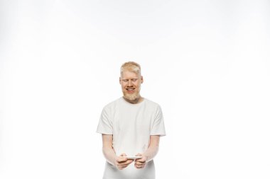 Beyaz arka planda akıllı telefon kullanan tişörtlü mutlu albino adam 