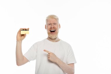 Beyaz tişörtlü albino adam kredi kartını işaret ediyor. 