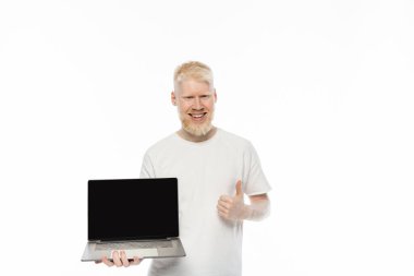 Tişörtlü sakallı albino adam elinde boş ekranlı dizüstü bilgisayarla beyaz ekranda baş parmağını gösteriyor. 