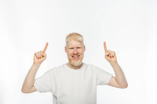 stock image cheerful albino man in t-shirt pointing with fingers on white background