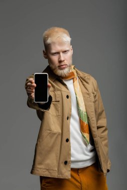 Beyaz ekranlı akıllı telefon tutan şık gömlekli, sakallı albino adam gri ekranda izole edilmiş. 