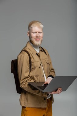 Sırt çantalı neşeli albino öğrencisi internette çalışırken gri renkte izole edilmiş.
