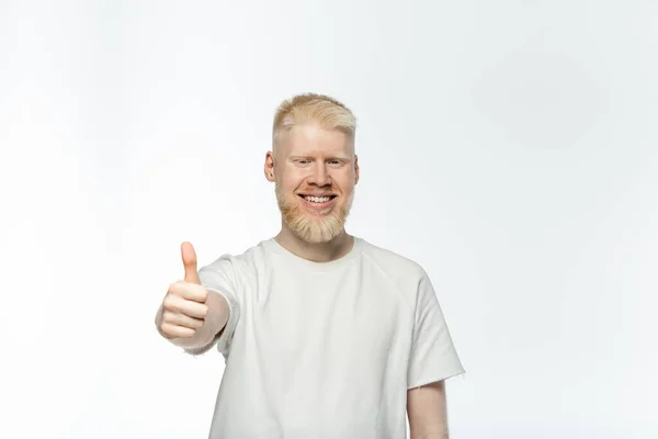 Barbuto albino uomo in t-shirt sorridente e mostrando pollice in su isolato su bianco — Foto stock