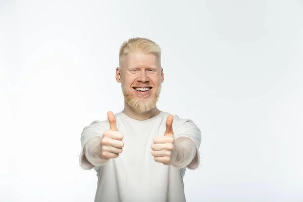 Bearded albino man in t-shirt smiling and showing thumbs up isolated on white — Stock Photo