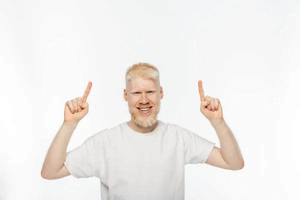 Cheerful albino man in t-shirt pointing with fingers on white background — Stock Photo