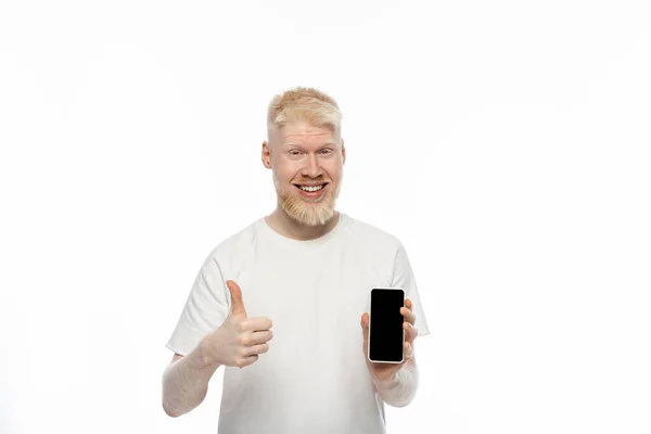 Happy albino man in t-shirt holding smartphone with blank screen and showing thumb up isolated on white — Stock Photo