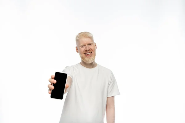 Happy albino man in t-shirt holding smartphone with blank screen on white background — Stock Photo
