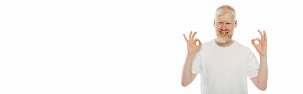 Felice uomo albino in t-shirt mostrando segno ok con le mani isolate su bianco, banner — Foto stock
