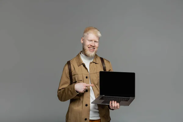 Cheerful albino man with backpack pointing at laptop with blank screen isolated on grey — Stock Photo