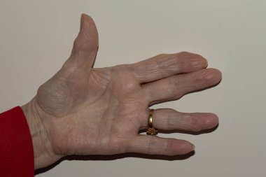 Üst düzey bir kadının tamamen açık olan elinin detaylı bir görüntüsü, desenli cildini ve doğal yaşlanma sürecini tüm parmakları ince bir arkaplana uzanmış olarak vurguluyor.