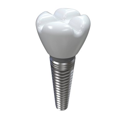 Karikatür dişi arka planda izole edilmiş. 3d görüntüleme, illüstrasyon