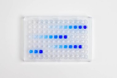 Laboratuvardaki laboratuvar masasından alınan örnekler.