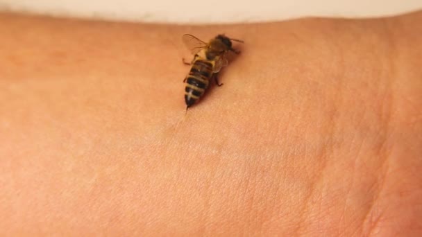 Медовая Пчела Жалит Человеку Руку Жало Пчела Покидает Ядовитый Мешок — стоковое видео