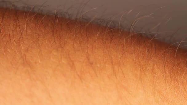 Erection Hair Goosebumps Closeup Male Arm Hair Rising Closeup Reflex — Stock Video