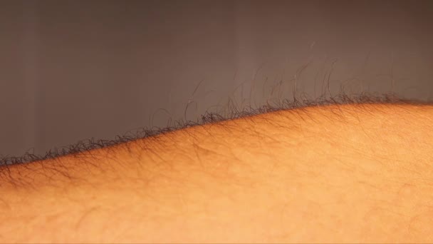 Erection Hair Goosebumps Closeup Male Arm Hair Rising Closeup Reflex — Stock Video