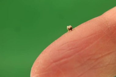 Bee's venom sac. Honey bee stings a man's finger. When the sting is over, the honeybee leaves the venom sac Notices it's still injecting the venom on its own by the pressure of the surrounding muscles