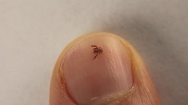Pseudoscorpion. Tırnağındaki sahte akrep boyutu karşılaştırması. Biyolog, egzotik veteriner, sahte akrep, vahşi yaşam veterineri. Eklembacaklılar, omurgasızlar. Böcek, böcek, hayvan, vahşi doğa.