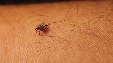 İnsan elinin üzerinde sürünen asalak bir kenenin yakın plan çekimi. Böcek ısırıkları ve vektör kaynaklı hastalıklardan kaynaklanan tehlikelerin gerçekçi bir tasviri, tıbbi, sağlık ve bilim projeleri için mükemmel.