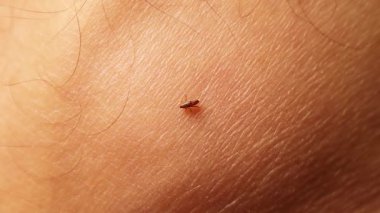 Saha görevi sırasında veterinerlerin ayak bileklerinden kan emen bir pirenin yakın çekimi. Kırsal kesimde pire ısırığı riski, enfeksiyon, hastalık ve mesleki riskler var..