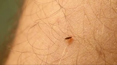 Bir kene bir adamın bacağına yuva yapar, ritmik olarak arkasını derinin derinlerine doğru hareket ettirir, bir kan damarını hedef alır. Parazit davranışların ve hayatta kalma içgüdüsünün ham ve ayrıntılı bir şekilde yakalanması..